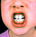 People, child, children, puberty, Health, Dentist, Dentists, Dentistry, teeth, occupation, occupations, dental, dental surgery, dental surgeries, people, child, children, puberty, child, children, teenager, teenagers, adolescent, adolescents, dental, surgery, surgeries, plaque, ab67,