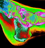 Health, x-ray, x-rays, xray, xrays, foot, feet, bone, bones, human bone, human bones, ankle, ankles, AB67,